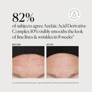 Azelaic Acid Derivative Complex 10% - Jumbo T5