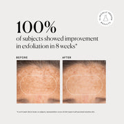 BHA Liquid Exfoliant 2% G0