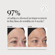 Retinol Complex Serum M1